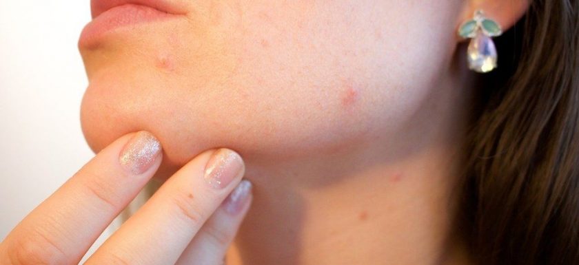 Metoder mot hudproblem
